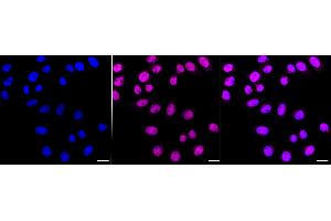 Immunocytochemical staining of HepG2 cells with Chromodomain helicase DNA binding protein 4 antibody (ABIN7800918), 1:1,000).