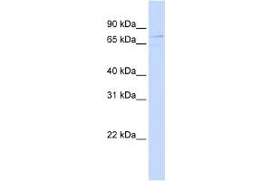 WB Suggested Anti-ZBTB3 Antibody Titration:  0. (ZBTB3 anticorps  (Middle Region))