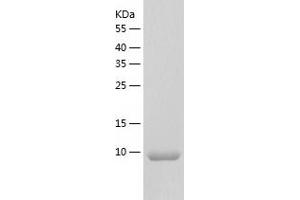 Western Blotting (WB) image for Colipase, Pancreatic (CLPS) (AA 18-112) protein (His tag) (ABIN7122440)