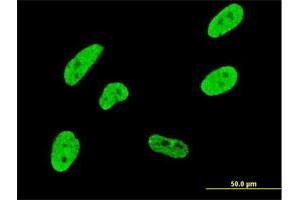 Immunofluorescence of monoclonal antibody to CDKL1 on HeLa cell. (CDKL1 anticorps  (AA 259-358))