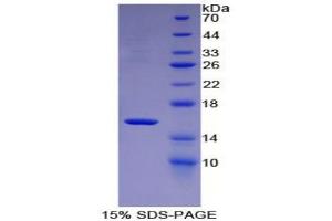 SDS-PAGE analysis of Mouse MBL2 Protein. (MBL2 Protéine)