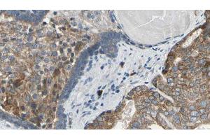 ABIN6269351 at 1/100 staining Human prostate tissue by IHC-P. (eIF4EBP1 anticorps  (Internal Region))