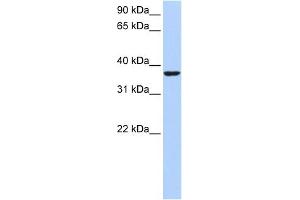 WB Suggested Anti-HMG20B Antibody Titration:  0. (HMG20B anticorps  (Middle Region))