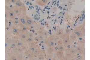 Detection of IL12A in Human Liver Tissue using Monoclonal Antibody to Interleukin 12A (IL12A) (IL12A anticorps  (AA 23-219))