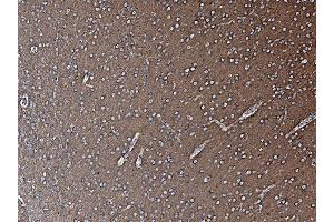 IHC analysis of NSF using anti-NSF antibody (ABIN7601630).