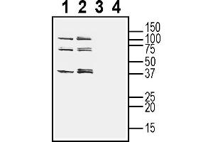 Western blot analysis of human  monocytic leukemia cell line lysate (lanes 1 and 3) and human  MG glioblastoma cell line lysate (2 and 4):3-4. (TMEM150C anticorps  (Extracellular))