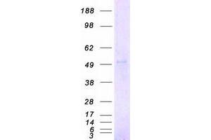 Validation with Western Blot