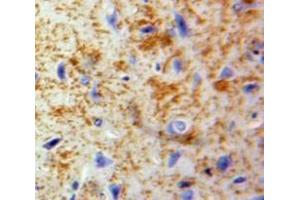 Used in DAB staining on fromalin fixed paraffin-embedded Brain tissue (CCL20 anticorps  (AA 24-95))