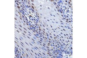 Immunohistochemistry of paraffin-embedded human esophageal using TP73 Rabbit pAb (ABIN6133470, ABIN6149430, ABIN6149431 and ABIN6213831) at dilution of 1:100 (40x lens).