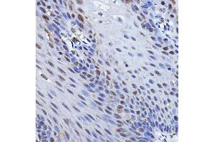 Immunohistochemistry of paraffin-embedded human esophageal using TP73 Rabbit pAb (ABIN6133470, ABIN6149430, ABIN6149431 and ABIN6213831) at dilution of 1:100 (40x lens). (Tumor Protein p73 anticorps  (AA 1-100))