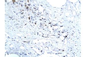Formalin-fixed and paraffin embedded human liver labeled with Anti-Hepatitis E Virus ORF3 Polyclonal Antibody, Unconjugated (ABIN726350) followed by conjugation to the secondary antibody and DAB staining (HEV ORF3 anticorps  (AA 22-103))