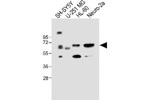 All lanes : Anti-CERK Antibody (C-term) at 1:1000 dilution Lane 1: SH-SY5Y whole cell lysate Lane 2: U-251 MG whole cell lysate Lane 3: HL-60 whole cell lysate Lane 4: Neuro-2a whole cell lysate Lysates/proteins at 20 μg per lane. (CERK anticorps  (C-Term))