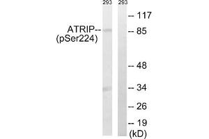 Western blot analysis of extracts from 292 cells, treated with UV (15 mins), using ATRIP (Phospho-Ser224) antibody. (ATRIP anticorps  (pSer224))
