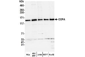 Western Blotting (WB) image for anti-Coatomer Protein Complex, Subunit alpha (COPA) (AA 1174-1224) antibody (ABIN7453067) (COPA anticorps  (AA 1174-1224))
