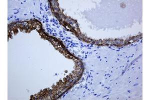 Image no. 1 for anti-Keratin 5 (KRT5) (AA 1-273) antibody (ABIN1490696)