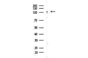 Western blot analysis of lysates from EC304 cells, using Eg5 Antibody at 1/1000 dilution.
