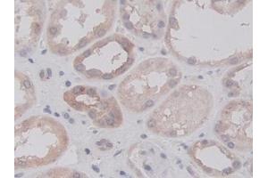 Detection of RALA in Human Kidney Tissue using Monoclonal Antibody to V-Ral Simian Leukemia Viral Oncogene Homolog A (RALA)