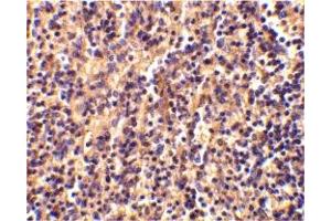 Immunohistochemistry (IHC) image for anti-Caspase 4, Apoptosis-Related Cysteine Peptidase (CASP4) (Middle Region) antibody (ABIN1030900)