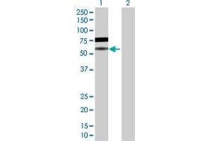 Western Blot analysis of BLNK expression in transfected 293T cell line by BLNK MaxPab polyclonal antibody. (B-Cell Linker anticorps  (AA 1-456))