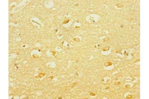 Immunohistochemistry of paraffin-embedded human brain tissue using ABIN7166564 at dilution of 1:100
