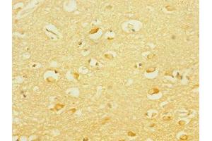 Immunohistochemistry of paraffin-embedded human brain tissue using ABIN7166564 at dilution of 1:100 (PCDH19 anticorps  (AA 568-678))