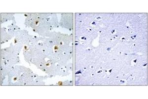 Immunohistochemistry analysis of paraffin-embedded human brain tissue, using FMN2 Antibody. (Formin 2 anticorps  (AA 1541-1590))