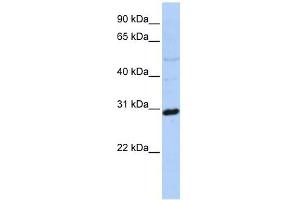 Metaxin 2 antibody used at 1 ug/ml to detect target protein. (MTX2 anticorps  (N-Term))