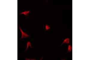 ABIN6266908 staining Hela by IF/ICC. (P18 INK anticorps)