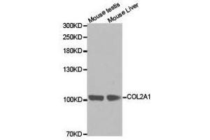 Western Blotting (WB) image for anti-Collagen, Type II, alpha 1 (COL2A1) antibody (ABIN1871948) (COL2A1 anticorps)