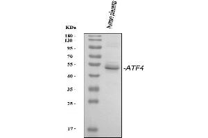 Western blot analysis of ATF4 using anti-ATF4 antibody (ABIN4886477).