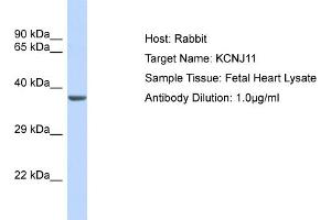 Host: Rabbit Target Name: KCNJ11 Sample Type: Fetal Heart lysates Antibody Dilution: 1. (KCNJ11 anticorps  (Middle Region))