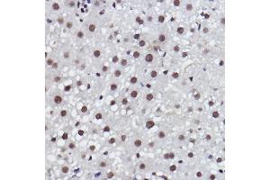 Immunohistochemistry of paraffin-embedded rat liver using MED4 Rabbit mAb (ABIN7268445) at dilution of 1:100 (40x lens). (MED4 anticorps)