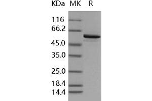 Western Blotting (WB) image for Bone Morphogenetic Protein Receptor, Type IB (BMPR1B) (AA 149-502) protein (GST tag,His tag) (ABIN7317106) (BMPR1B Protein (AA 149-502) (GST tag,His tag))