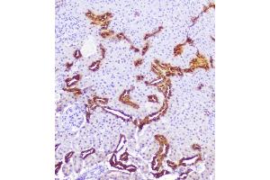 IHC analysis of Calbindin using anti-Calbindin antibody (ABIN6719541). (CALB1 anticorps  (AA 2-261))