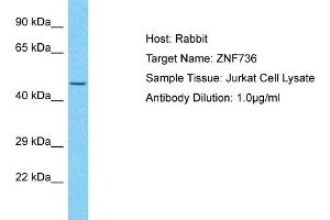 Host: Rabbit Target Name: ZNF736 Sample Type: Jurkat Whole Cell lysates Antibody Dilution: 1. (ZNF736 anticorps  (N-Term))