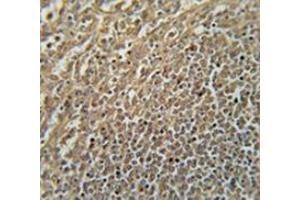 Immunohistochemistry analysis in human spleen tissue (Formalin-fixed, Paraffin-embedded) using RASAL3  Antibody (C-term), followed by peroxidase conjugated secondary antibody and DAB staining.