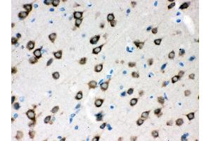 Anti- SMN1/2 Picoband antibody,IHC(P) IHC(P): Rat Brain Tissue