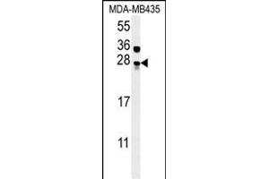 MUTED Antibody (Center) (ABIN654098 and ABIN2843982) western blot analysis in MDA-M cell line lysates (15 μg/lane). (MUTED anticorps  (AA 40-68))
