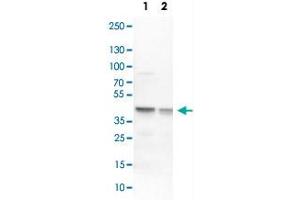 Western Blot analysis of Lane 1: NIH-3T3 cell lysate (mouse embryonic fibroblast cells) and Lane 2: NBT-II cell lysate (Wistar rat bladder tumour cells) with ECH1 polyclonal antibody . (ECH1 anticorps)