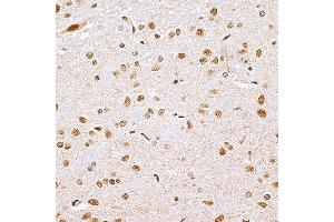 Immunohistochemistry of paraffin-embedded rat brain using CBX6 antibody (ABIN6127558, ABIN6138026, ABIN6138027 and ABIN6221185) at dilution of 1:100 (40x lens). (CBX6 anticorps  (AA 80-180))