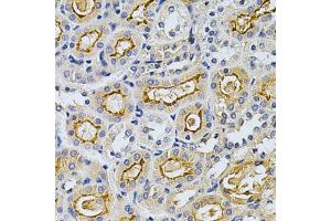 Immunohistochemistry of paraffin-embedded mouse kidney using ADRBK1 Antibody (ABIN5970824) at dilution of 1/200 (40x lens). (GRK2 anticorps)