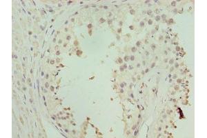 Immunohistochemistry of paraffin-embedded human testis tissue using ABIN7176343 at dilution of 1:100 (ZNF546 anticorps  (AA 101-400))