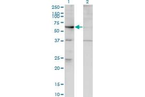 Western Blot analysis of ARHGEF5 expression in transfected 293T cell line by ARHGEF5 monoclonal antibody (M02), clone 4D10-D11. (ARHGEF5 anticorps  (AA 1-519))