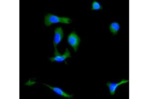 Immunocytochemistry analysis of Mouse MSC cells using Ly-6G Antibody. (Ly6g anticorps)