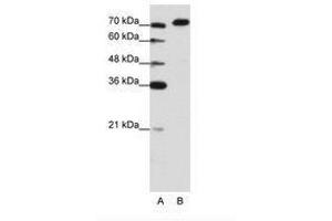 Image no. 3 for anti-A Kinase (PRKA) Anchor Protein 8-Like (AKAP8L) (C-Term) antibody (ABIN202849) (AKAP8L anticorps  (C-Term))