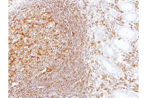 IHC-P Image Immunohistochemical analysis of paraffin-embedded human gastric N+T, using LBP, antibody at 1:100 dilution. (LBP anticorps)