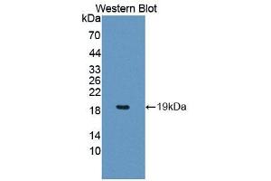 Western blot analysis of the recombinant protein. (PCCA anticorps  (AA 580-728))