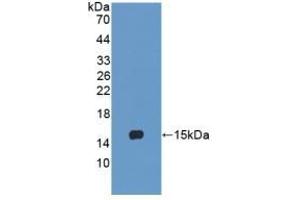 Detection of Recombinant LY96, Human using Polyclonal Antibody to Lymphocyte Antigen 96 (LY96) (LY96 anticorps  (AA 19-130))