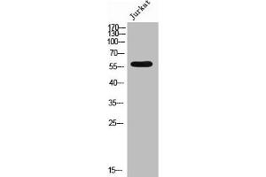 Western Blot analysis of JK cells using Phospho-4. (EPB41 anticorps  (pTyr660))