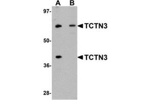 Western blot analysis of TCTN3 in HeLa cell lysate with TCTN3 antibody at (A) 1 and (B) 2 μg/ml. (TCTN3 anticorps  (C-Term))